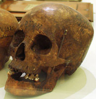 Skull of an Indigenous person held in a museum's collection.