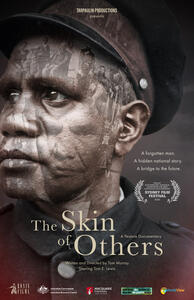 The Skin of Others